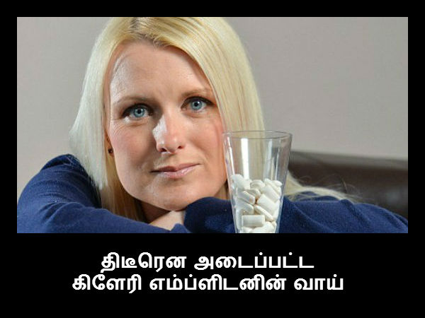 திடீரென அடைப்பட்ட கிளேரி எம்ப்ளிடனின் வாய் 