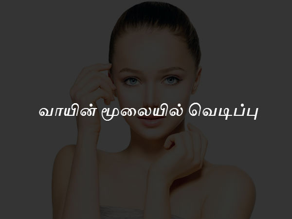 வாயின் மூலையில் வெடிப்பு 