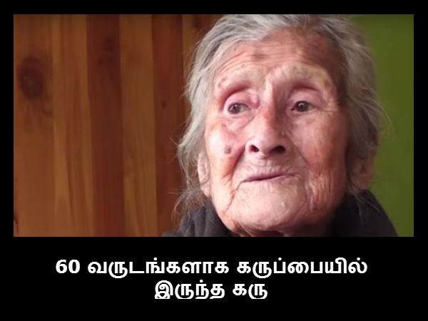 60 வருடங்களாக கருப்பையில் இருந்த கரு 