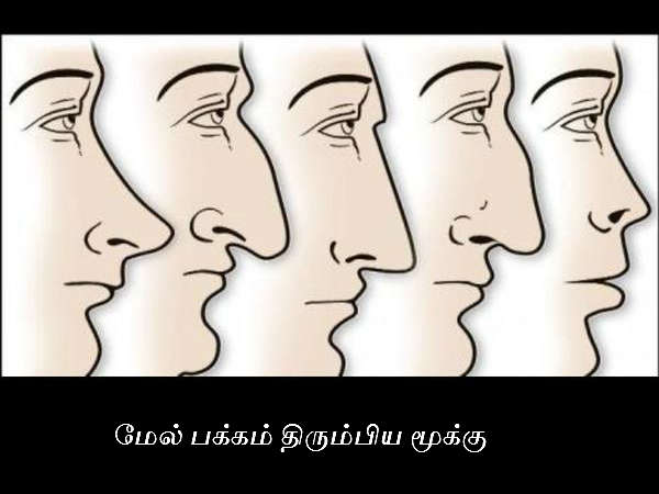 மேல் பக்கம் திரும்பிய மூக்கு