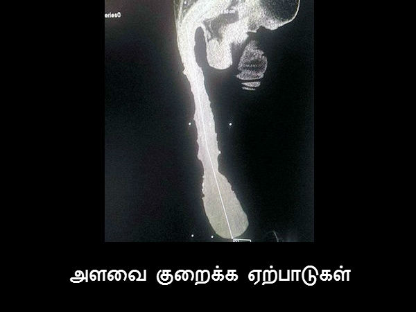 அளவை குறைக்க ஏற்பாடுகள் 