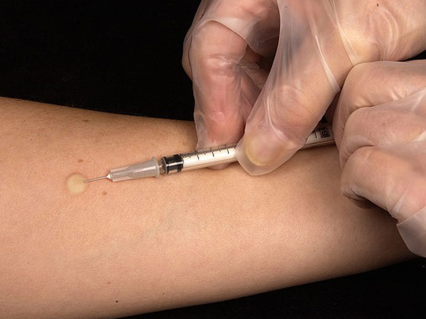 பரிசோதனை செய்து கொள்ள பயம்