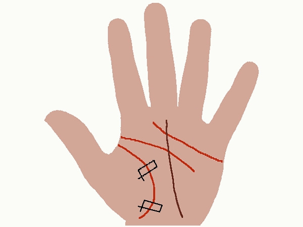 சதுரங்கள் (Squares)