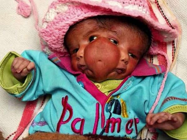 இரு முகம் கொண்ட குழந்தை