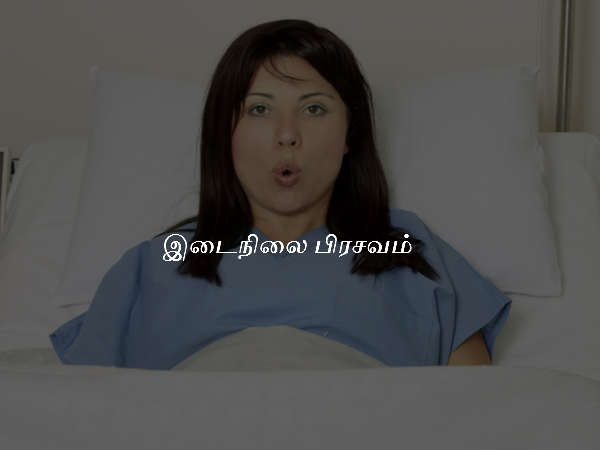 இடைநிலை பிரசவம் 