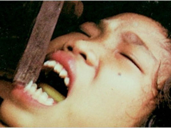 மென்த்தவாய் பற்கள் கூர்மைப் படுத்துதல் (Mentawai Teeth Cheseling) 