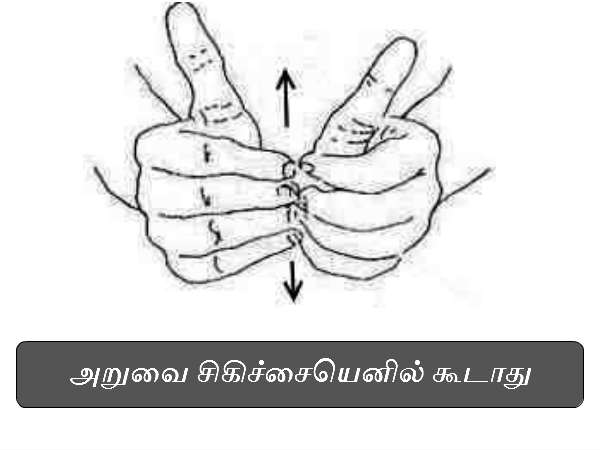 அறுவை சிகிச்சையெனில் கூடாது