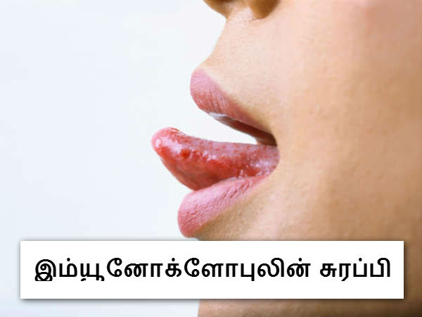 இம்யூனோக்ளோபுலின் சுரப்பி 
