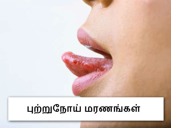 புற்றுநோய் மரணங்கள் 