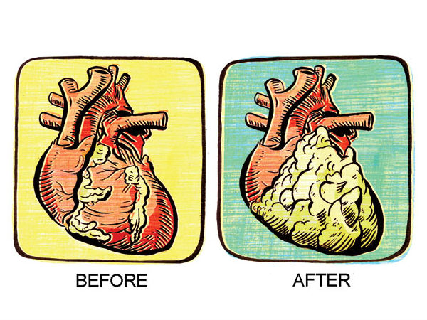 தெளிவற்ற அறிகுறிகள் 