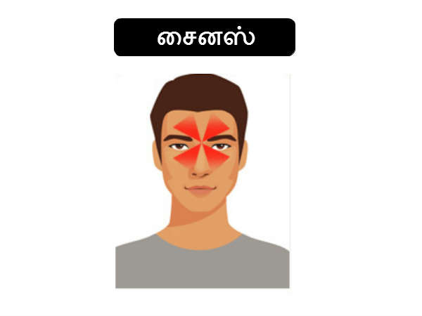 டென்சன் தலைவலி டென்சன் தலைவலி