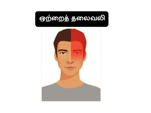 சைனஸ் தலைவலி சைனஸ் தலைவலி