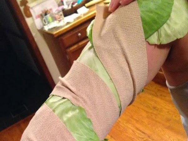 வீக்கம் 