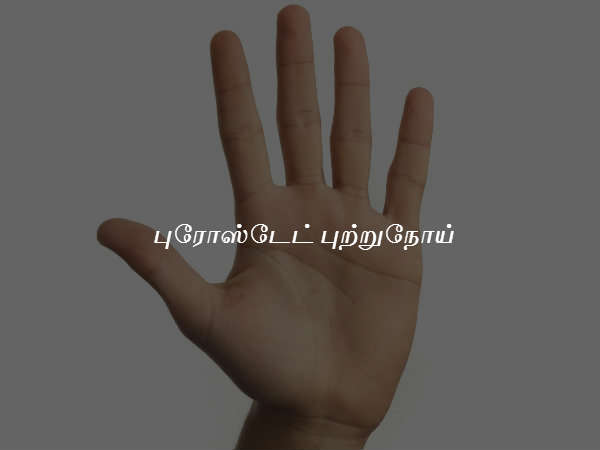 புரோஸ்டேட் புற்றுநோய்