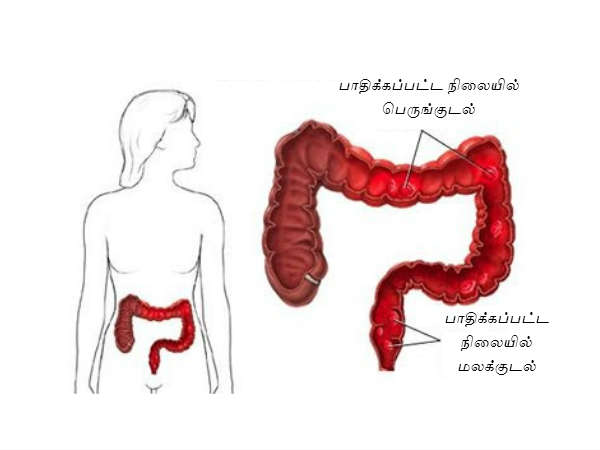 குறிப்பு