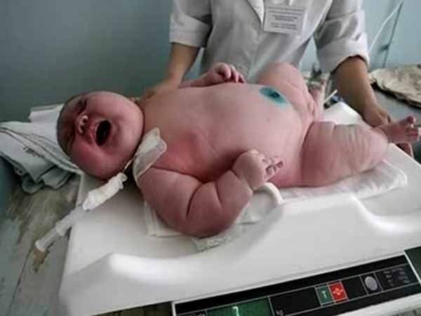 அடிமில்டன் டோஸ் சாண்டோஸ் (பிரேசில்) அடிமில்டன் டோஸ் சாண்டோஸ் (பிரேசில்)