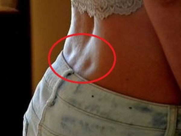 அப்போலோ ஹோல்ஸ் 