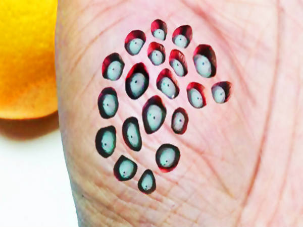 Trypophobia
