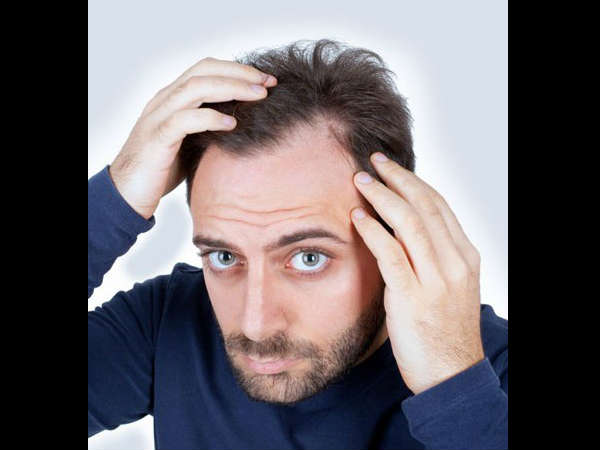 சிறு வட்ட பகுதியில் முடி அதிகம் உதிர்வது சிறு வட்ட பகுதியில் முடி அதிகம் உதிர்வது