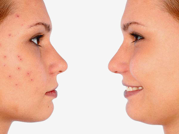 குறிப்பு