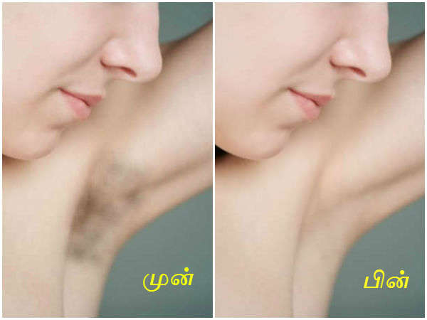 பரிந்துரை #1