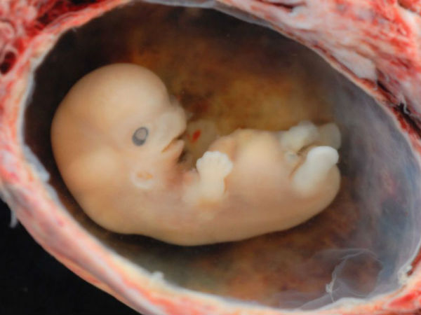 சிறுநீர் பரிசோதனை!