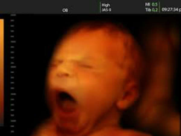 உண்மை #4 உண்மை #4