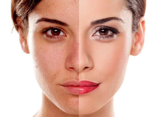 Benefits of pearl facial