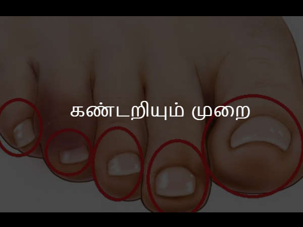 கண்டறியும் முறை