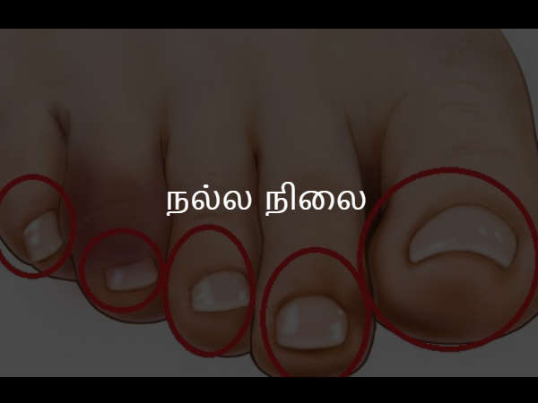 நல்ல நிலை
