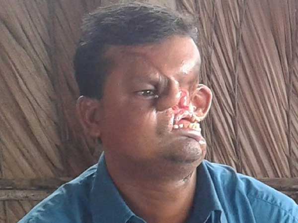 வெளிவந்த ஹாஷ்மோத் அலி!