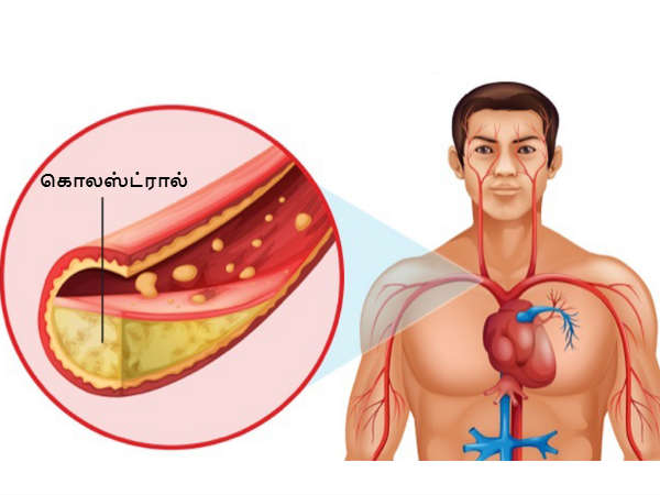 குறிப்பு