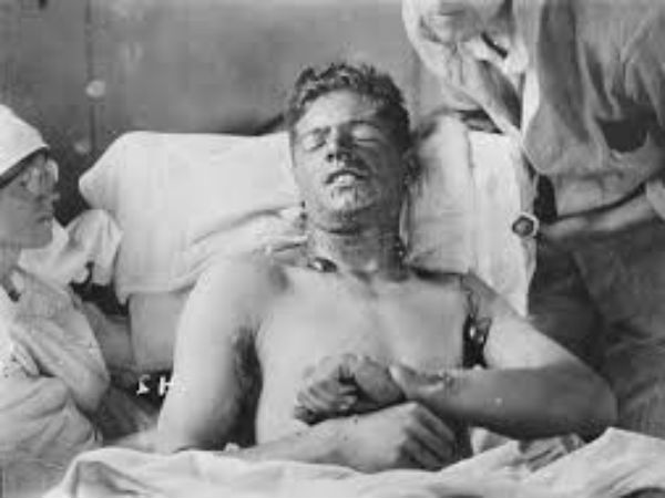 மஸ்டர்ட் கேஸ்! மஸ்டர்ட் கேஸ்!