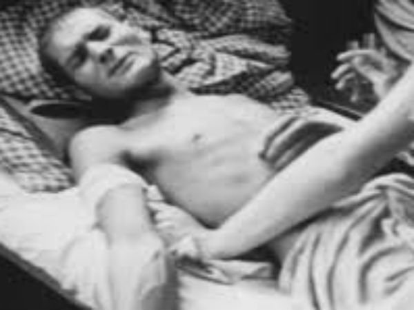 கதிர்வீச்சு பரிசோதனை! கதிர்வீச்சு பரிசோதனை!