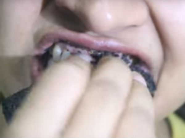 பற்களில் தேய்க்க வேண்டும். 