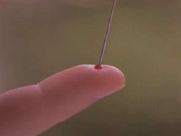 ஊசி மருத்துவம் ஊசி மருத்துவம்