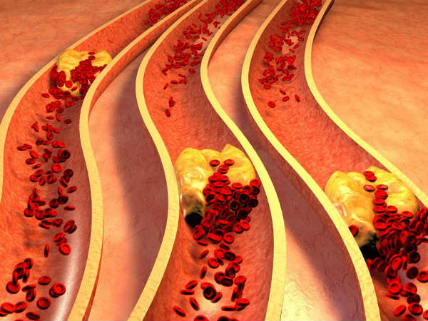 உட்கொள்ளும் முறை உட்கொள்ளும் முறை