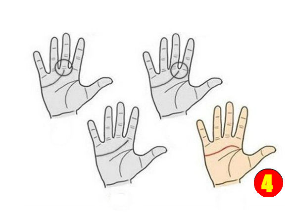 நான்காம் வகை