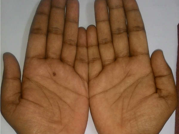 இதய ரேகைகள் ஒரே அளவில் இருந்தால்... இதய ரேகைகள் ஒரே அளவில் இருந்தால்...