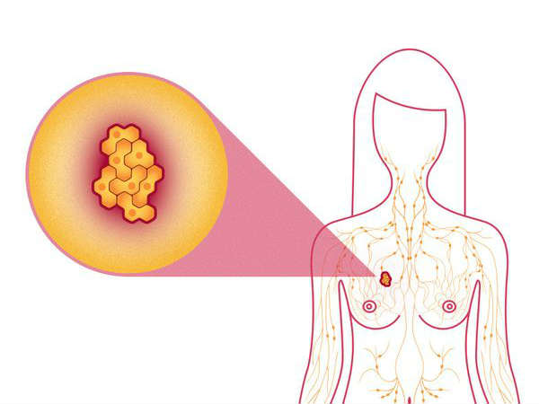 Seven Superfoods That Can Prevent Breast Cancer Seven Superfoods That Can Prevent Breast Cancer