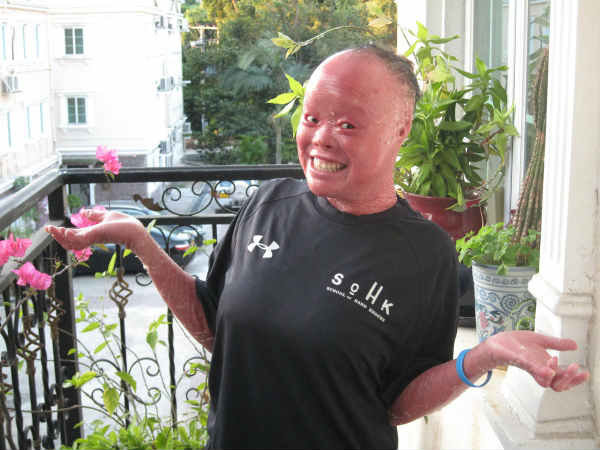 போராடிய முய்!