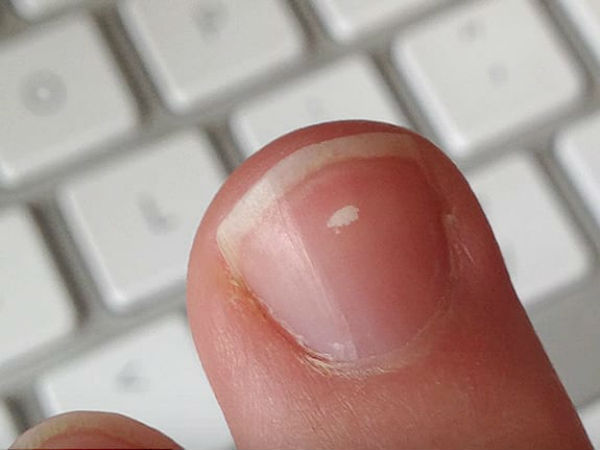 தீங்கற்றது?