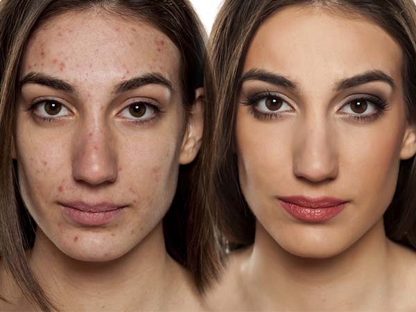 பயன்படுத்தும் முறை: