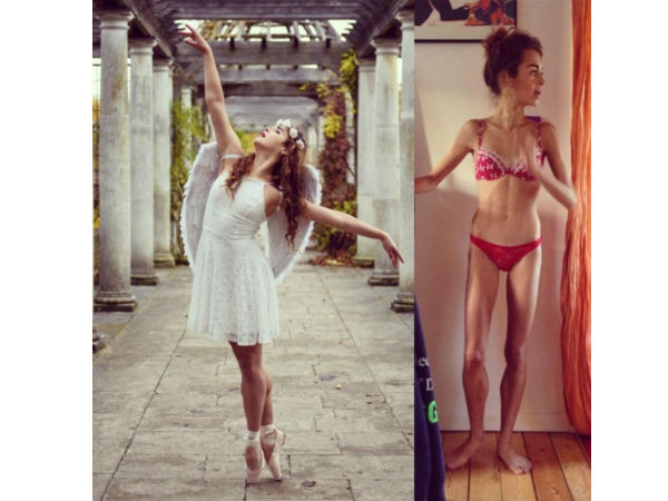 அனோரெக்ஸிக்!