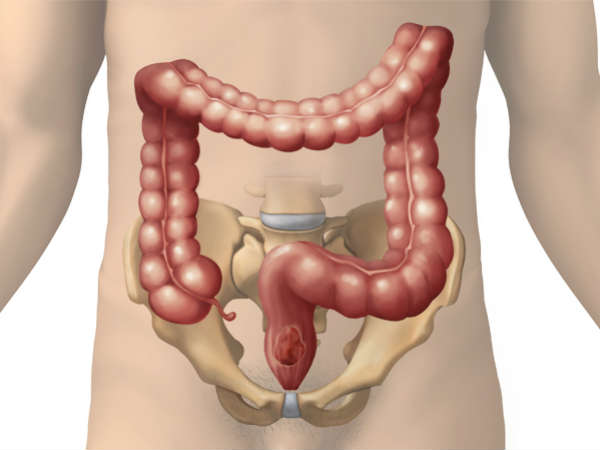 அறிகுறிகள் அறிகுறிகள்