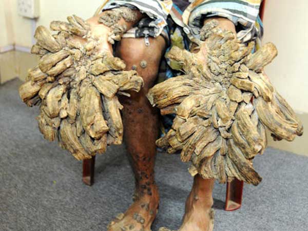 வங்காள அரசின் இலவச சிகிச்சை