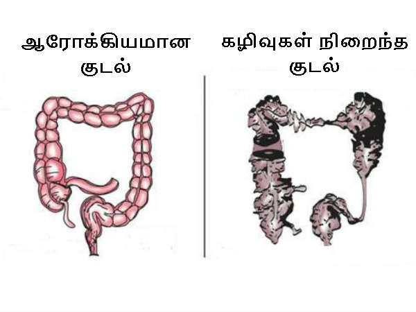 Say Bye Bye To 8kg Toxins From The Body In Believe It or Not Just 10 Days Say Bye Bye To 8kg Toxins From The Body In Believe It or Not Just 10 Days