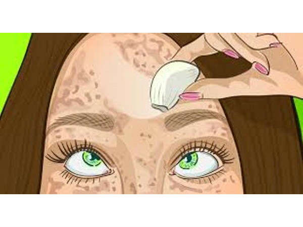 This Ancient Remedy That Will Erase The Spots From Your Skin Like With A Rubber This Ancient Remedy That Will Erase The Spots From Your Skin Like With A Rubber