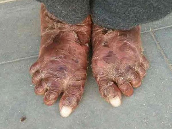 சிகிச்சை இல்லை! சிகிச்சை இல்லை!