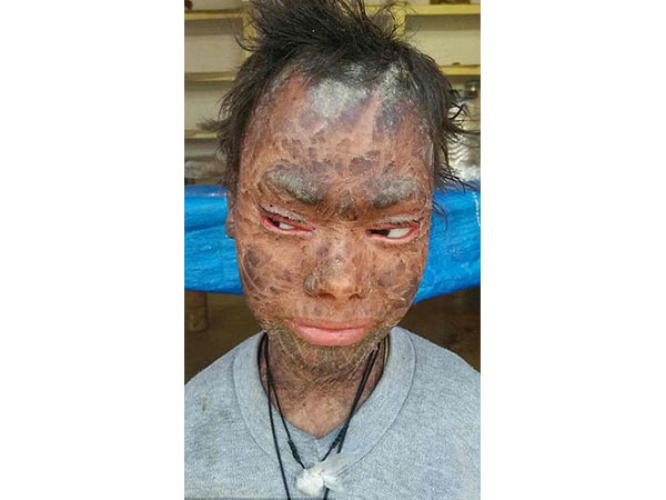 ஷாலினி.... ஷாலினி....